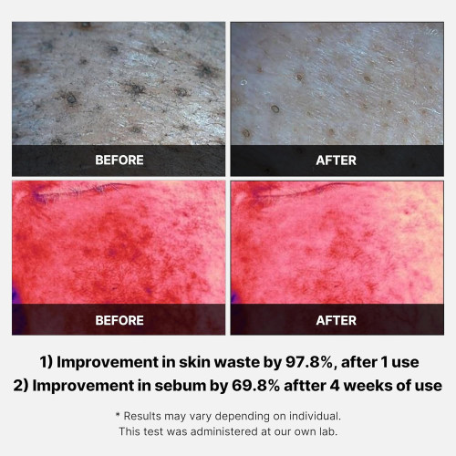 Medicube Red Succinic Acid Peeling Pad 70ks