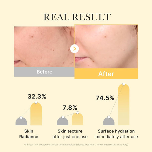 Medicube Kojic Acid Turmeric Brightening Gel Mask 4ks